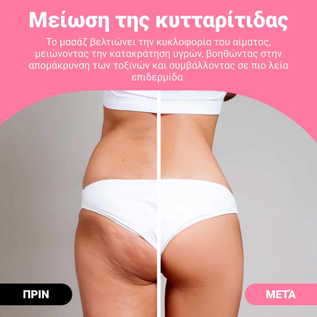 GUASHA – ρολό μασάζ διαμόρφωσης σώματος για ορατή μείωση κυτταρίτιδας και λίπους - Image 2